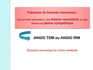 Fractures du foramen transverse :
Peuvent être associées à des lésions vasculaires ou des
lésions du plexus sympathique
ANGIO TDM ou ANGIO IRM
Dissection traumatique de l’artère vertébrale
 