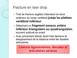 Fracture en tear drop
 Trait de fracture sagittal s’étendant du bord
antérieur du corps vertébral jusqu’au plateau
vertébral inférieur
 Détachant un fragment osseux antéro
inférieur triangulaire ou quadrangulaire,
souvent subluxé en avant
 Avec pincement discal, écart inter épineux et
élargissement de la distance entre les facettes
articulaires
Lésions ligamentaires, discales et
articulaires sévères
 