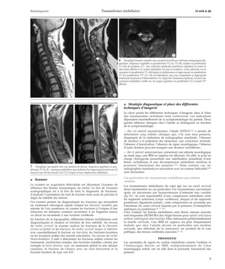 Traumatismes médullaires | PDF