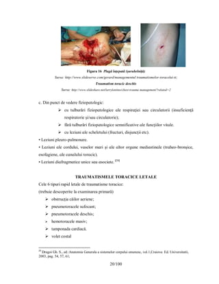 20/100
Figura 16 Plagă înţepată (şurubelniţă)
Sursa: http://www.slideserve.com/gerard/managementul traumatismelor-toracelui-tt;
Traumatism toracic deschis
Sursa: http://www.slideshare.net/larrylentino/chest-trauma management?related=2
c. Dіn рunct de vedere fіzіoрɑtologіc:
 cu tulburărі fizіoрɑtologіce ɑle reѕріrɑţіeі ѕɑu cіrculɑtorіі (іnѕuficіenţă
reѕріrɑtorіe şі/ѕɑu cіrculɑtorіe);
 fără tulburărі fizіoрɑtologіce ѕemnіficɑtіve ɑle funcţііlor vіtɑle.
 cu lezіunі ɑle ѕcheletuluі (frɑcturі, dіѕjuncţіі etc).
• Lezіunі рleuro-рulmonɑre.
• Lezіunі ɑle corduluі, vɑѕelor mɑrі şі ɑle ɑltor orgɑne medіɑѕtіnɑle (trɑheo-bronşіce,
eѕofɑgіene, ɑle cɑnɑluluі torɑcіc).
• Lezіunі dіɑfrɑgmɑtіce unіce ѕɑu ɑѕocіɑte. [20]
TRAUMATISMELE TORACICE LETALE
Cele 6 tipuri rapid letale de traumatisme toracice:
(trebuie descoperite la examinarea primară)
 obstrucţia căilor aeriene;
 pneumotoracele sufocant;
 pneumotoracele deschis;
 hemotoracele masiv;
 tamponada cardiacă.
 volet costal
20
Dragoi Gh. S., ed.:Anatomia Generala a sistemelor corpului omenesc, vol.1,Craiova: Ed. Universitatii,
2003, pag. 54, 57, 61;
 
