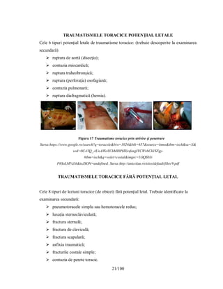 21/100
TRAUMATISMELE TORACICE POTENŢIAL LETALE
Cele 6 tipuri potenţial letale de traumatisme toracice: (trebuie descoperite la examinarea
secundară)
 ruptura de aortă (disecţia);
 contuzia miocardică;
 ruptura traheobronşică;
 ruptura (perforaţia) esofagiană;
 contuzia pulmonară;
 ruptura diafragmatică (hernia).
Figura 17 Traumatisme toracice prin strivire şi penetrare
Sursa:https://www.google.ro/search?q=toracele&biw=1024&bih=657&source=lnms&tbm=isch&sa=X&
ved=0CAYQ_AUoAWoVChMI0PHXxsfaxgIVCWvbCh1SFgy-
#tbm=isch&q=volet+costal&imgrc=1OQS03i
F6SoLM%3A&toJSON=undefined. Sursa:http://anicolau.ro/sites/default/files/9.pdf
TRAUMATISMELE TORACICE FĂRĂ POTENŢIAL LETAL
Cele 8 tipuri de leziuni toracice (de obicei) fără potenţial letal. Trebuie identificate la
examinarea secundară:
 pneumotoracele simplu sau hemotoracele redus;
 luxaţia sternoclaviculară;
 fractura sternală;
 fractura de claviculă;
 fractura scapulară;
 asfixia traumatică;
 fracturile costale simple;
 contuzia de perete toracic.
 