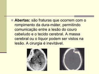 Abertas: são fraturas que ocorrem com o
rompimento da dura-máter, permitindo
comunicação entre a lesão do couro
cabeludo e o tecido cerebral. A massa
cerebral ou o líquor podem ser vistos na
lesão. A cirurgia é inevitável.
 