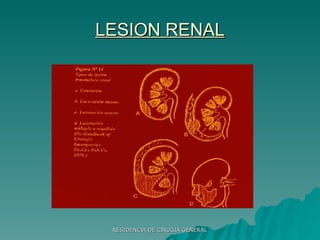 LESION RENAL 