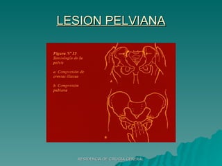 LESION PELVIANA 