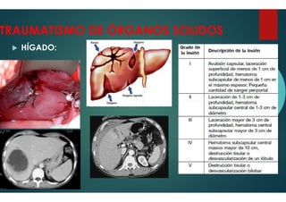 TRAUMATISMO DE ÓRGANOS SOLIDOS
HÍGADO:
TRAUMATISMO DE ÓRGANOS SOLIDOS
 