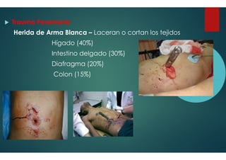 Trauma Penetrante
Herida de Arma Blanca – Laceran o cortan los tejidos
Hígado (40%)
Intestino delgado (30%)
Diafragma (20%)
Colon (15%)
Laceran o cortan los tejidos
Intestino delgado (30%)
 