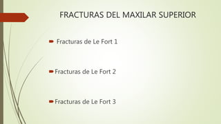 FRACTURAS DEL MAXILAR SUPERIOR
 Fracturas de Le Fort 1
Fracturas de Le Fort 2
Fracturas de Le Fort 3
 
