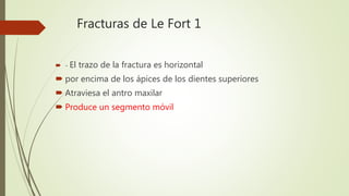  - El trazo de la fractura es horizontal
 por encima de los ápices de los dientes superiores
 Atraviesa el antro maxilar
 Produce un segmento móvil
Fracturas de Le Fort 1
 