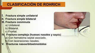 CLASIFICACIÓN DE ROHRICH
I. Fractura simple unilateral
II. Fractura simple bilateral
III. Fractura conminuta
a) Unilateral.
b) Bilateral.
c) Frontal.
IV. Fractura compleja (huesos nasales y septo)
a) Con hematoma septal asociado.
b) Con laceraciones nasales.
V. Fracturas nasoorbitoetmoidales
 