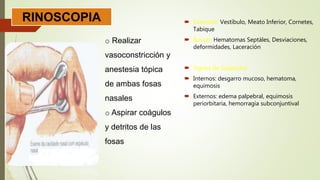 o Realizar
vasoconstricción y
anestesia tópica
de ambas fosas
nasales
o Aspirar coágulos
y detritos de las
fosas
RINOSCOPIA  Examinar: Vestíbulo, Meato Inferior, Cornetes,
Tabique
 Buscar: Hematomas Septáles, Desviaciones,
deformidades, Laceración
 Signos de Sospecha:
 Internos: desgarro mucoso, hematoma,
equimosis
 Externos: edema palpebral, equimosis
periorbitaria, hemorragia subconjuntival
 