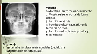 Ventajas
1. Muestra el antro maxilar claramente
2. Muestra el seno frontal de forma
oblicua
3. Permite ver órbita
4. Permite evaluar traumatismo de
tercio medio facial
5. Permite evaluar huesos propios y
fosas nasales
Desventaja
1. No permite ver claramente etmoides (debido a la
superposición de estructuras)
 