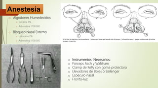 o Anestesia Local:
o Algodones Humedecidos
o Cocaína 4%
o Adrenalina 1:100.000
o Bloqueo Nasal Externo
o Lidocaína 2%
o Adrenalina 1:100.000
o Instrumentos Necesarios:
o Forceps Asch y Walsham
o Clamp de Kelly con goma protectora
o Elevadores de Boies o Ballenger
o Espéculo nasal
o Fronto-luz
Anestesia
 