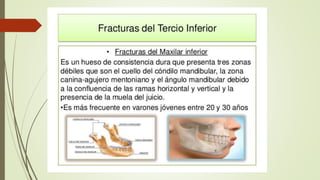 Traumatismo facial- final