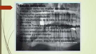 Traumatismo facial- final