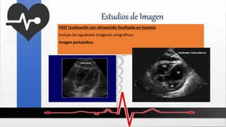 Estudios de Imagen
FAST (evaluación con ultrasonido focalizada en trauma)
Incluye las siguientes imágenes ecográficas:
Imagen pericárdica:
 
