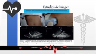 Estudios de Imagen
Imagen del cuadrante superior izquierdo (fosa esplenorrenal)
 