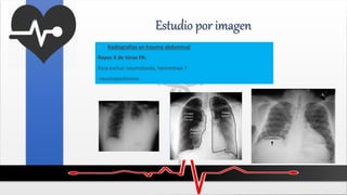 Estudio por imagen
 Radiografías en trauma abdominal
Rayos X de tórax PA:
Para excluir neumotoráx, hemotórax Y
neumoperitoneo.
 