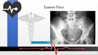 Examen Físico
Rayos X de pelvis
 