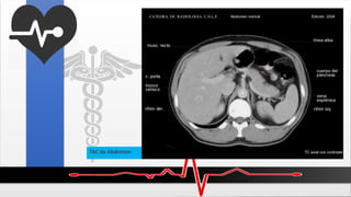 TAC de Abdomen
 
