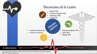 Mecanismo de la Lesión
• Hígado 40%
• Intestino delgado 30%
• Diafragma 20%
• Colon 15%
• Intestino delgado 50%
• Colon 40%
• Hígado 30%
• Heridas Penetrantes
• Lesiones contusas
Br. Moisés Morles
ATLS, Soporte Vital Avanzado en Trauma, Manual de Curso para estudiantes, 9na Edición. American
College of Surgeons. Pag. 124-126
 