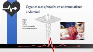 Órganos mas afectados en un traumatismo
abdominal
Higado
Bazo
Colon
Intestino delgado
Pancreas y duodeno
 