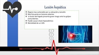 Lesión hepática
 Órgano mas vulnerable por su ubicación y tamaño
 Mas frecuente en lesiones abiertas
 la lesión del hígado presenta grave riesgo ante los golpes
contundentes
 Puede causar shock hipovolémico
 Mortalidad de un 10%
 
