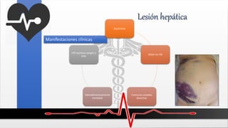 Lesión hepática
Manifestaciones clínicas
Equimosis
Dolor en HD
Fracturas costales
derechas
Hemodinamicamente
inestable
LPD positivo sangre o
bilis
 