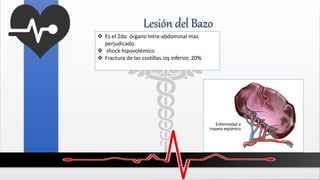 Lesión del Bazo
 Es el 2do órgano intra-abdominal mas
perjudicado.
 shock hipovolémico
 Fractura de las costillas izq inferior, 20%
 