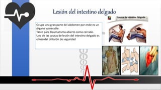 Lesión del intestino delgado
Ocupa una gran parte del abdomen por ende es un
órgano vulnerable.
Tanto para traumatismo abierto como cerrado.
Una de las causas de lesión del intestino delgado es
el uso del cinturón de seguridad
 