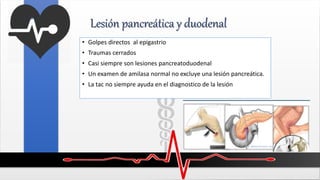 Lesión pancreática y duodenal
• Golpes directos al epigastrio
• Traumas cerrados
• Casi siempre son lesiones pancreatoduodenal
• Un examen de amilasa normal no excluye una lesión pancreática.
• La tac no siempre ayuda en el diagnostico de la lesión
 