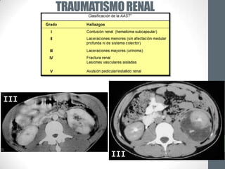 TRAUMATISMO RENAL




III                       II




               III
 
