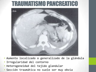 TRAUMATISMO PANCREATICO




•   Aumento localizado o generalizado de la glándula
•   Irregularidad del contorno
•   Heterogeneidad del tejido glandular
•   Sección traumática no suele ser muy obvia
 