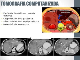 TOMOGRAFIA COMPUTARIZADA
• Paciente hemodinamicamente
  estable
• Cooperación del paciente
• Efectividad del equipo médico
• Material de contraste
 