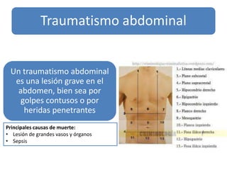 Traumatismo abdominal

Un traumatismo abdominal
es una lesión grave en el
abdomen, bien sea por
golpes contusos o por
heridas penetrantes
Principales causas de muerte:
• Lesión de grandes vasos y órganos
• Sepsis

 