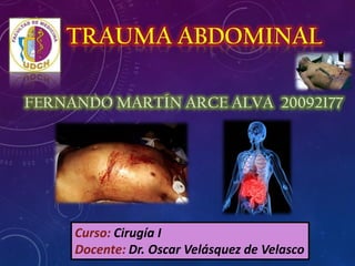 TRAUMA ABDOMINAL
FERNANDO MARTÍN ARCE ALVA 20092177
Curso: Cirugía I
Docente: Dr. Oscar Velásquez de Velasco
 