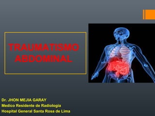 TRAUMATISMO
ABDOMINAL
Dr. JHON MEJIA GARAY
Medico Residente de Radiologia
Hospital General Santa Rosa de Lima
 