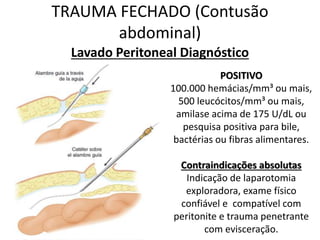 Lavado Peritoneal Diagnóstico
TRAUMA FECHADO (Contusão
abdominal)
POSITIVO
100.000 hemácias/mm³ ou mais,
500 leucócitos/mm³ ou mais,
amilase acima de 175 U/dL ou
pesquisa positiva para bile,
bactérias ou fibras alimentares.
Contraindicações absolutas
Indicação de laparotomia
exploradora, exame físico
confiável e compatível com
peritonite e trauma penetrante
com evisceração.
 
