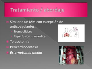    Similar a un IAM con excepción de
    anticoagulantes:
    › Trombolíticos
    › Reperfusion miocardica
 Toracotomía
 Pericardiocentesis
 Esternotomía media
 