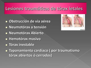 Lesiones traumáticas de tórax letales

   Obstrucción de vía aérea
   Neumotórax a tensión
   Neumotórax Abierto
   Hemotórax masivo
   Tórax inestable
   Taponamiento cardíaco ( por traumatismo
    tórax abiertos ó cerrados)
 