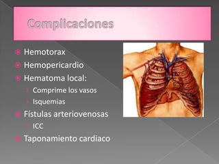  Hemotorax
 Hemopericardio
 Hematoma local:
    › Comprime los vasos
    › Isquemias
   Fístulas arteriovenosas
    › ICC
   Taponamiento cardiaco
 