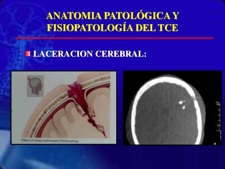 El tratamiento medicamentoso del alcoholismo los preparados las revocaciones