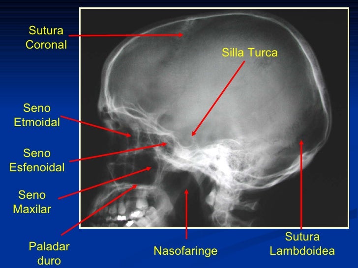 Traumatismo Craneo Cerebral Radiologia Dr Figueroa FCM-UNAH