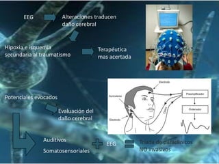 Alteraciones traducen
daño cerebral

EEG

Hipoxia e isquemia
secundaria al traumatismo

Terapéutica
mas acertada

Potenciales evocados
Evaluación del
daño cerebral

Auditivos
Somatosensoriales

EEG

Triada de paraclínicos
NO invasivos

 