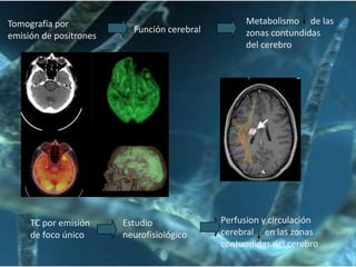 Tomografía por
emisión de positrones

TC por emisión
de foco único

Función cerebral

Estudio
neurofisiológico

Metabolismo de las
zonas contundidas
del cerebro

Perfusion y circulación
cerebral en las zonas
contundidas del cerebro

 