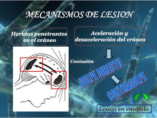 Dolor cervicalSIGNOS Y SINTOMASSignos:Craneohipertensivo Dilatación pupilar, caída del parpado, inmovilidad del globo ocular (III par craneal) o incapacidad de llevar el globo ocular hacia afuera (VI par)