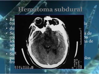 MECANISMOS DE LESIONAceleración y desaceleración del cráneoHeridas penetrantes en el cráneoContusión GOLPE DIRECTOCONTRAGOLPELesión en encéfalo