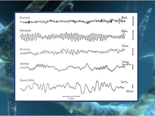 Sindromeorganico cerebralAmbos hemisferiosForma difusaDisminución de la atension y memoriaApatia, indiferenciaDaño irreversible