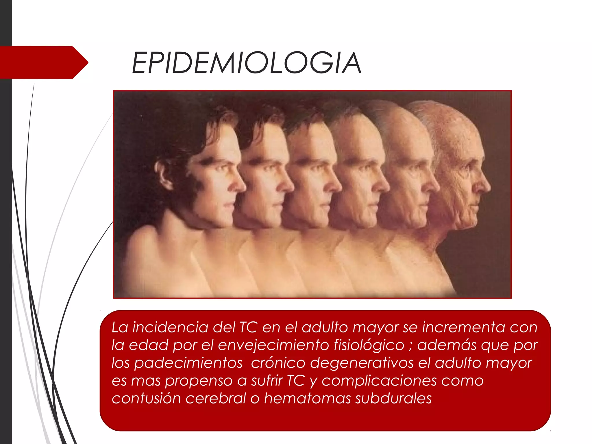 EPIDEMIOLOGIA 
La incidencia del TC en el adulto mayor se incrementa con 
la edad por el envejecimiento fisiológico ; además que por 
los padecimientos crónico degenerativos el adulto mayor 
es mas propenso a sufrir TC y complicaciones como 
contusión cerebral o hematomas subdurales 
 