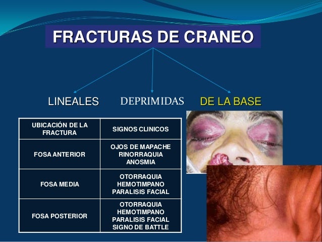 Traumatismo craneoencefalico 2