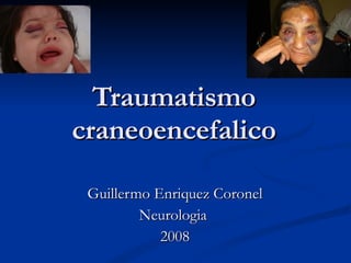 Traumatismo craneoencefalico Guillermo Enriquez Coronel Neurologia  2008 